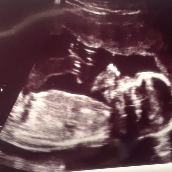 Meet your Posher, Nashell - Picture 1 of 1